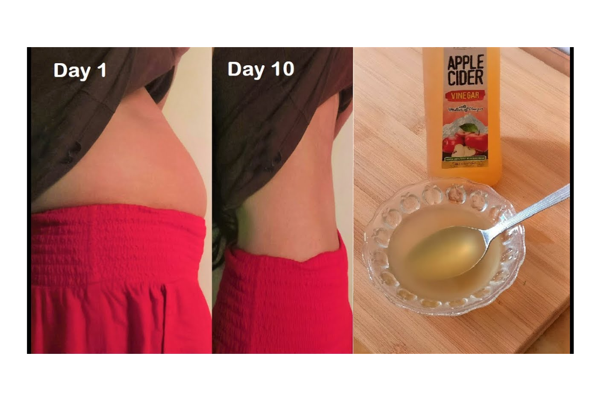 Apple Cider Vinegar Weight Loss Results