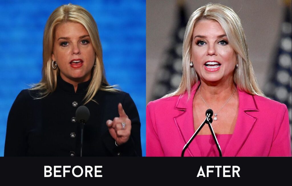 Former Attorney General Pam Bondi Weight Loss: 50 Pounds Lost in 2025, From 200 Pounds to 150 Pounds