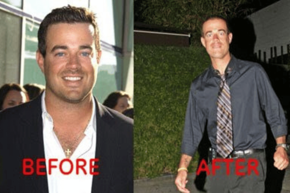 Why Is Carson Daly So Fat