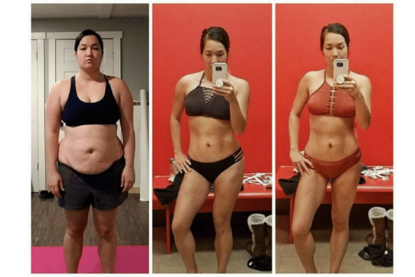 Overcoming Common Challenges When Trying to Lose Weight on Metformin