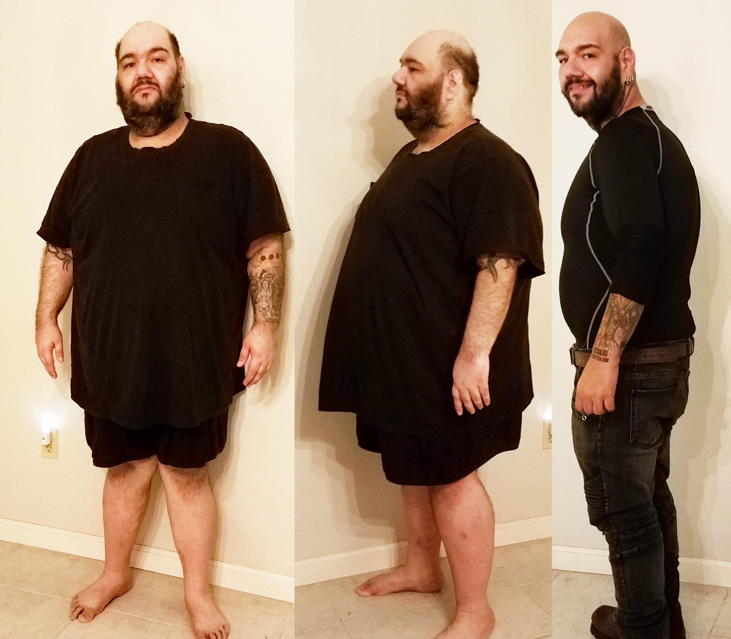 can glp 1 be taken orally A new oral GLP-1 medication has just launched in the United States. For  many patients, this represents another important step forward in the  treatment of obesity and metabolic disease. Unlike the injectable