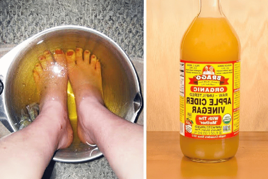 Apple Cider Vinegar on Feet Weight Loss: Transform Your Body in 2025
