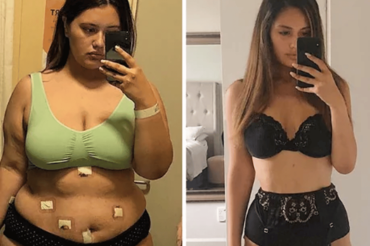 why should you avoid alcohol after b12 injection Botox and Alcohol: What to Know After Treatment – Beauty O'Clock Medical Spa main image 0