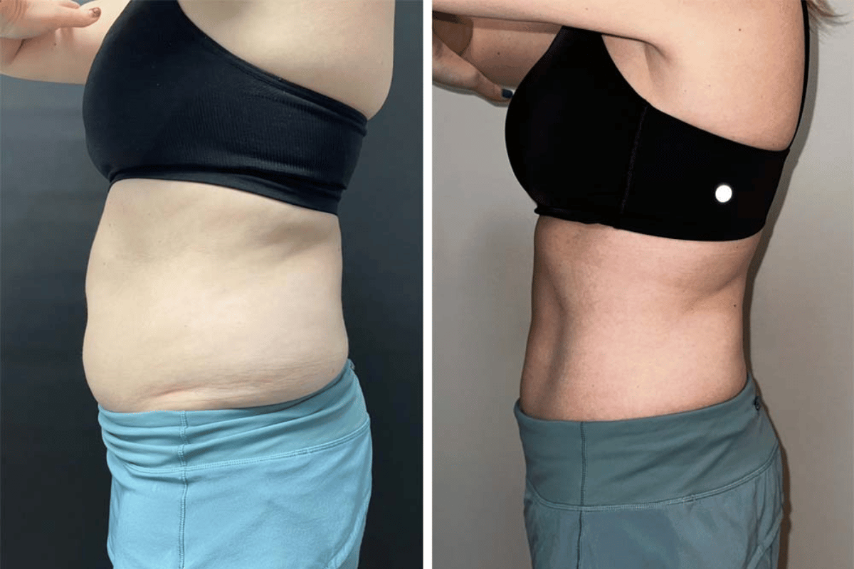 average weight loss on compounded tirzepatide Compounded Tirzepatide Weight Loss Results: Best Ways to Modern-style Plan  Hit Your Target Before Christmas – SkyNet Worldwide Express
