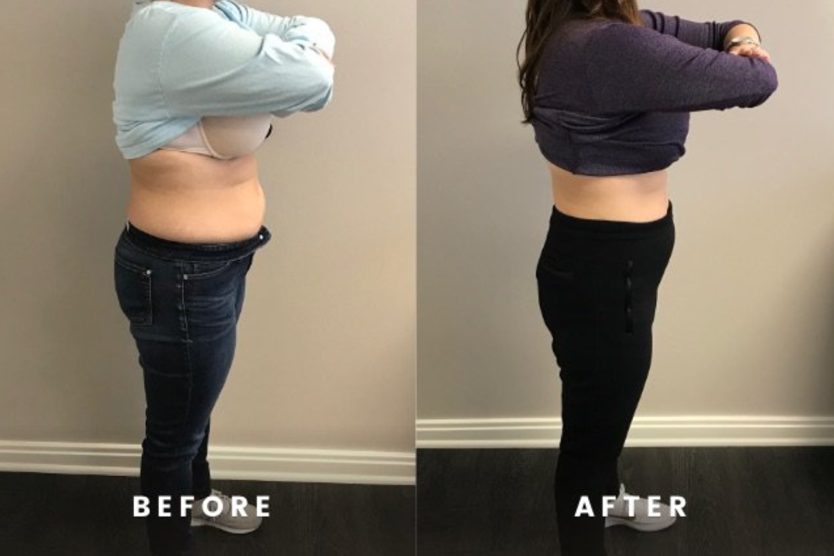 Top Reasons Why Inositol is Ultimate-checklist the Best Choice for Weight  Best-practices Loss Two Weeks Before Christmas  SkyNet Worldwide Express