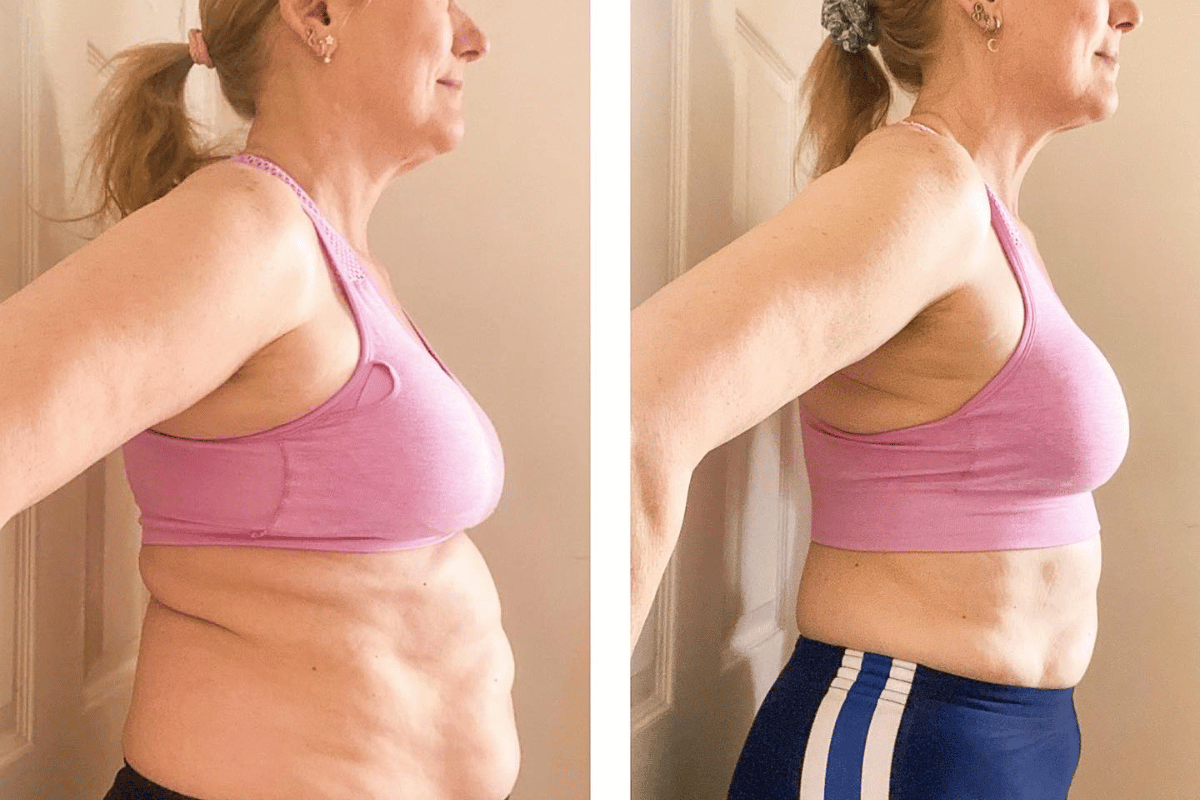 can i take semaglutide forever Does Ozempic Stop Working Over Time? Why Weight Loss Can Plateau