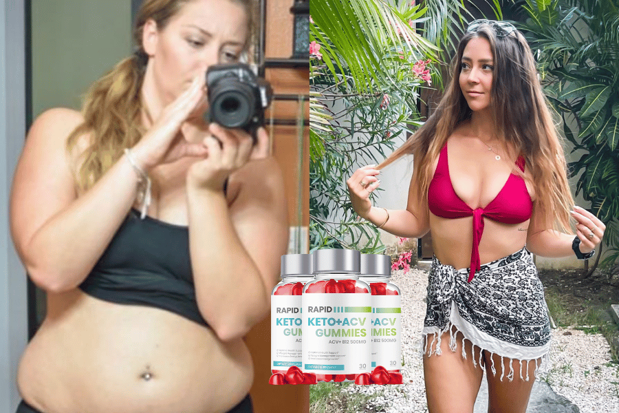 semaglutide non injection ✨ Wegovy® (Semaglutide Tablets) ✨ One of our recent patients lost 17 pounds  in just 30 days! 👏👏👏 Looking for a non-injection, FDA approved,  weight-loss option? Oral Wegovy® is now available by