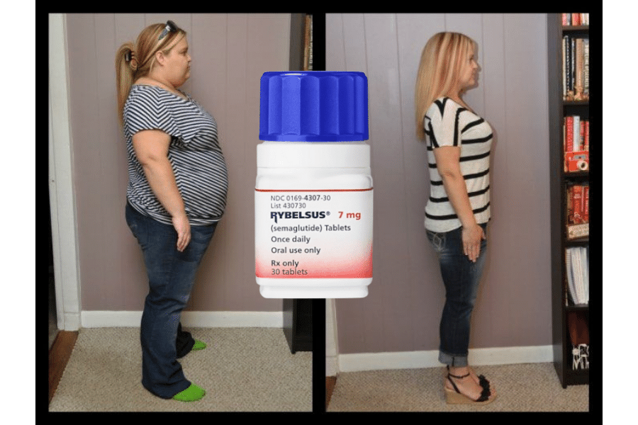 semaglutide gastroparesis law office in dallas Ozempic - Wegovy - Rybelsus semaglutide gastroparesis law office in dallas Ozempic - Wegovy - Rybelsus