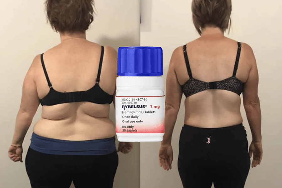 can i take semaglutide to lose 15 pounds Semaglutide Pills Achieve-more Weight Loss: 15-Pound Success in Manager 35  Days for Abdominal Obesity – SkyNet Worldwide Express
