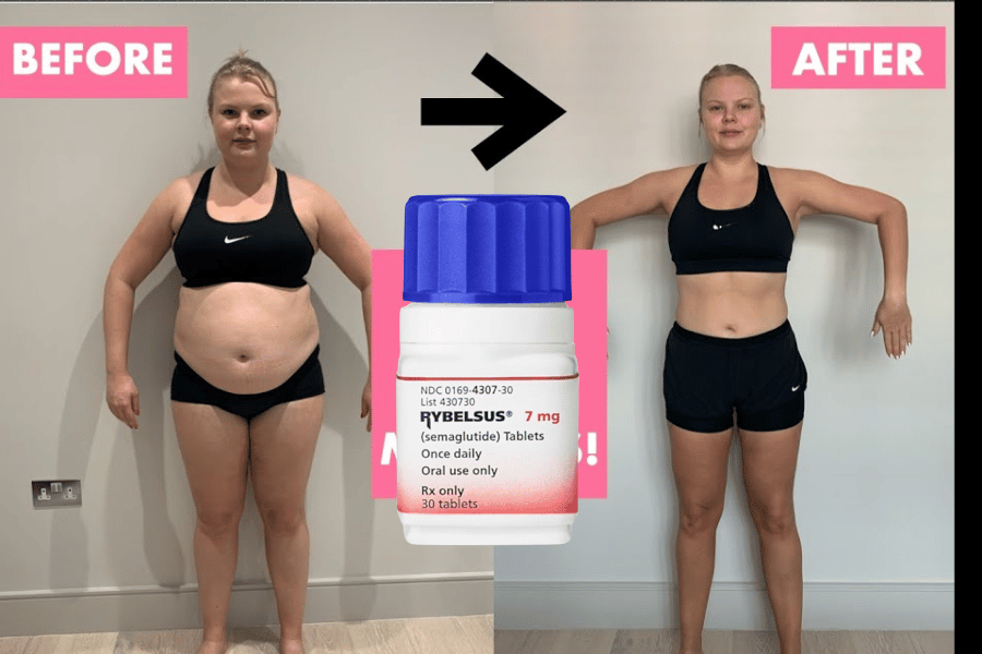 semaglutide before or after eating Weight Loss Funny Images Potential Side Effects and Safety Considerations