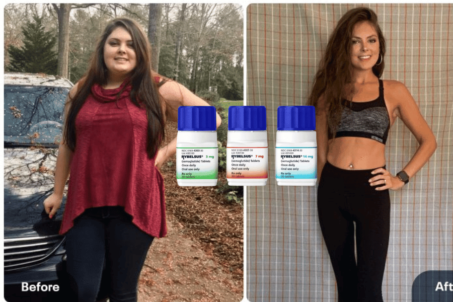 Semaglutide Pills Hot Weight Loss: 3-Pound Popular Success in 10 Days for  Facial Obesity  SkyNet Worldwide Express