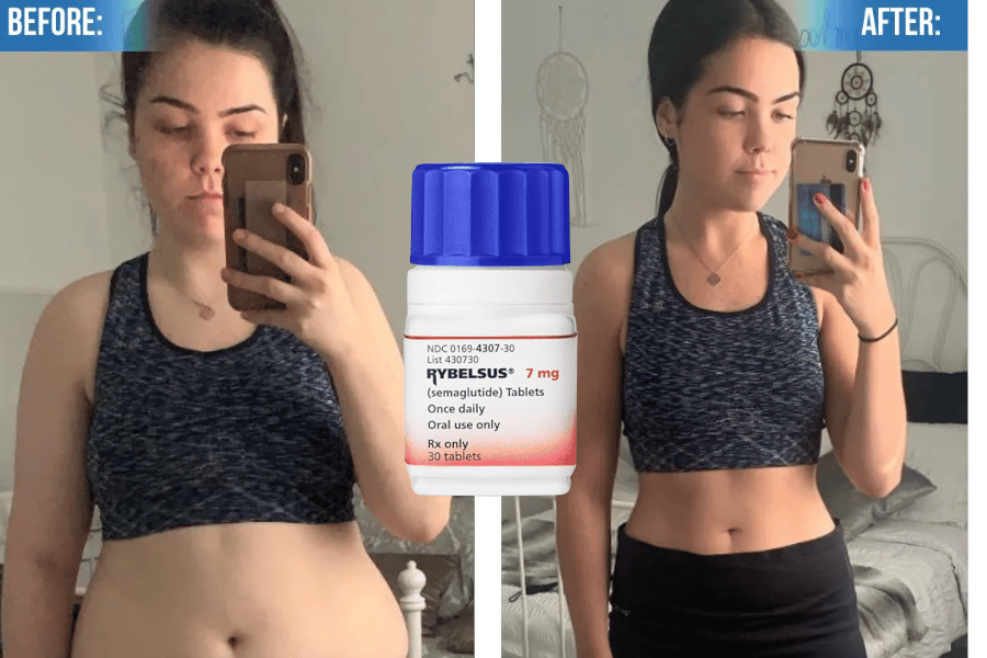 semaglutide success stories expert analysis Semaglutide Pills Achieve-more Weight Loss: 15-Pound Success in Manager 35  Days for Abdominal Obesity – SkyNet Worldwide Express