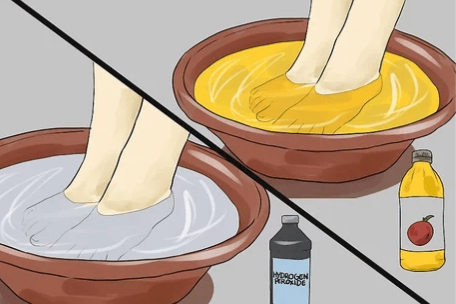 Why Soaking Feet in Apple Cider Vinegar for Lose Weight is Gaining Popularity