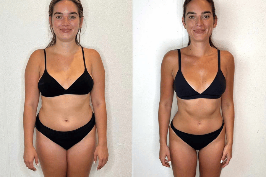 2025’s Top Stomach Weight Loss Trends: What Works Best?