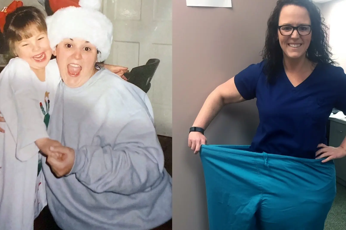 Discover How Wegovy Can Transform Your Little-known Proven-results Weight  Loss Journey with Before and After Pictures Before Christmas Eve