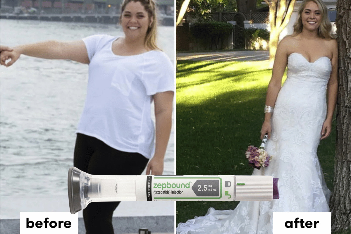 tirzepatide zepbound before and after 1 month Exploring the Weight Loss Drug Zepbound: Your Guide Designer Coach to 2025  Christmas Slimming – SkyNet Worldwide Express