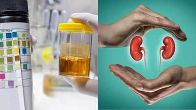 semaglutide urine color What causes urine colour changes in Gain kidney failure Elevate