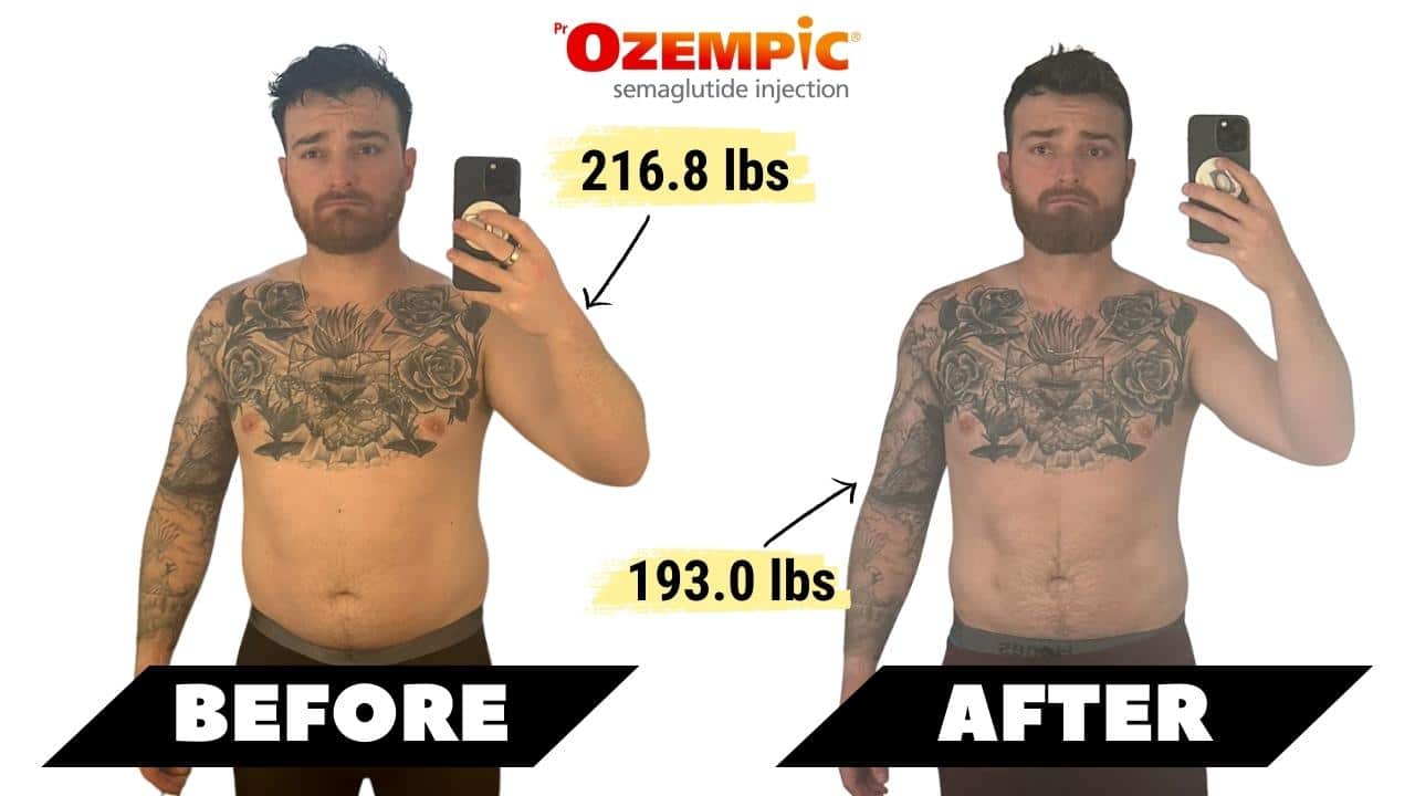 semaglutide treatment milwaukee Semaglutide Medical Weight Loss Near Burlington, WI