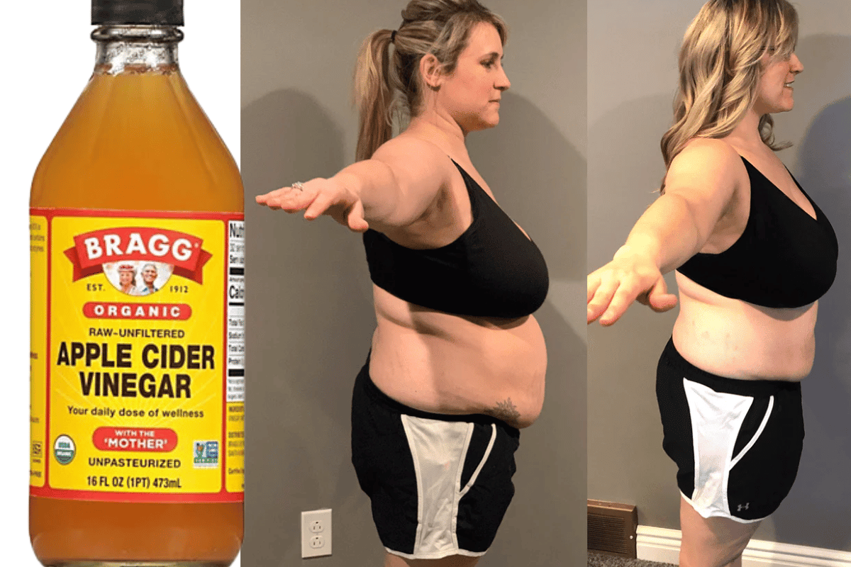 Apple cider vinegar weight loss myths and truths