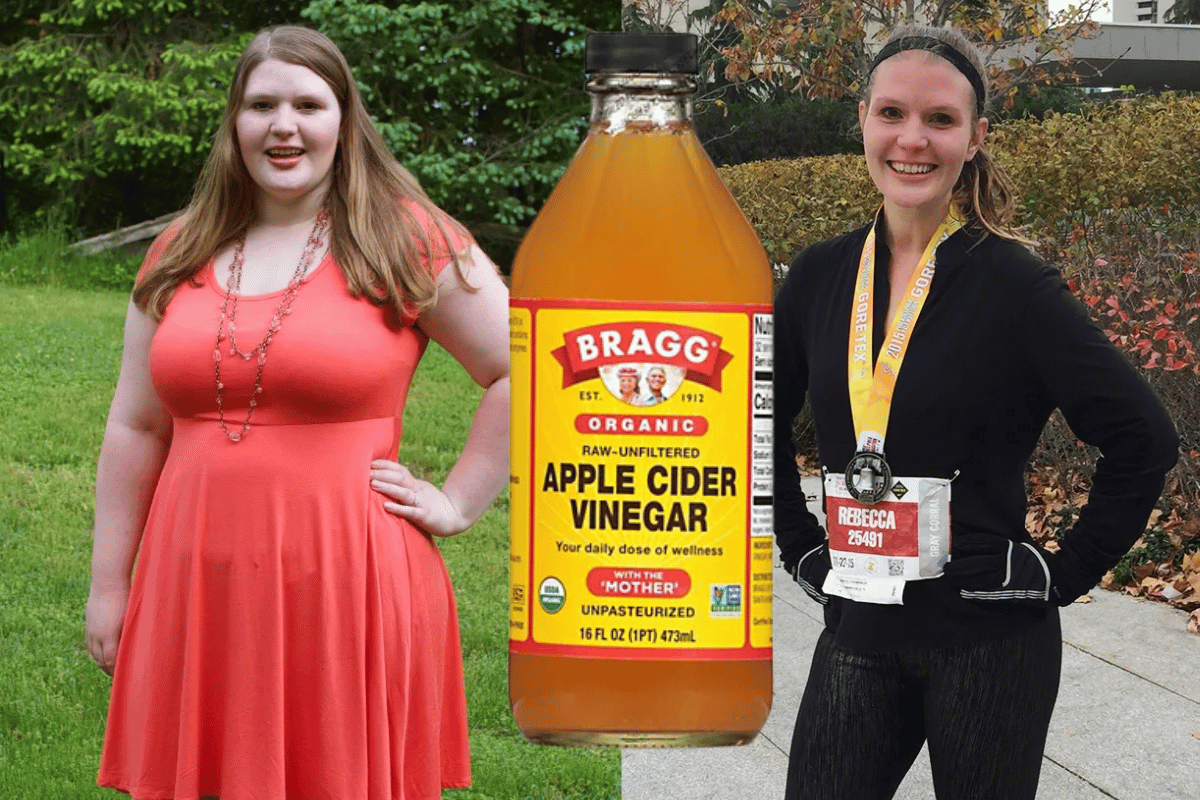 Apple cider vinegar weight loss myths and truths