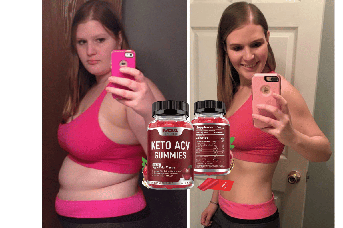 keto start acv gummies reviews