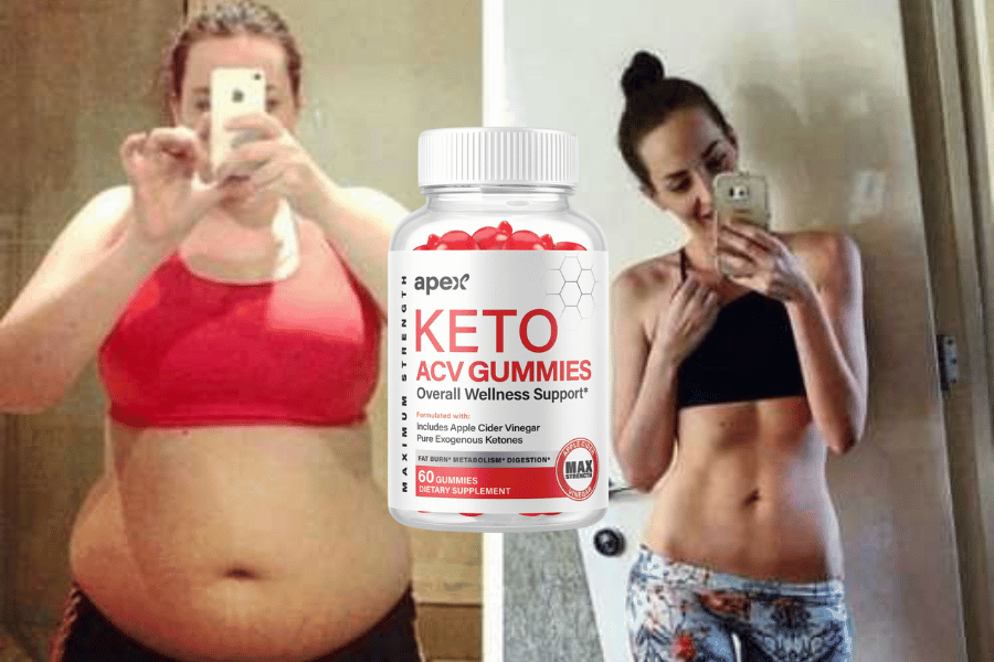 apex keto gummies