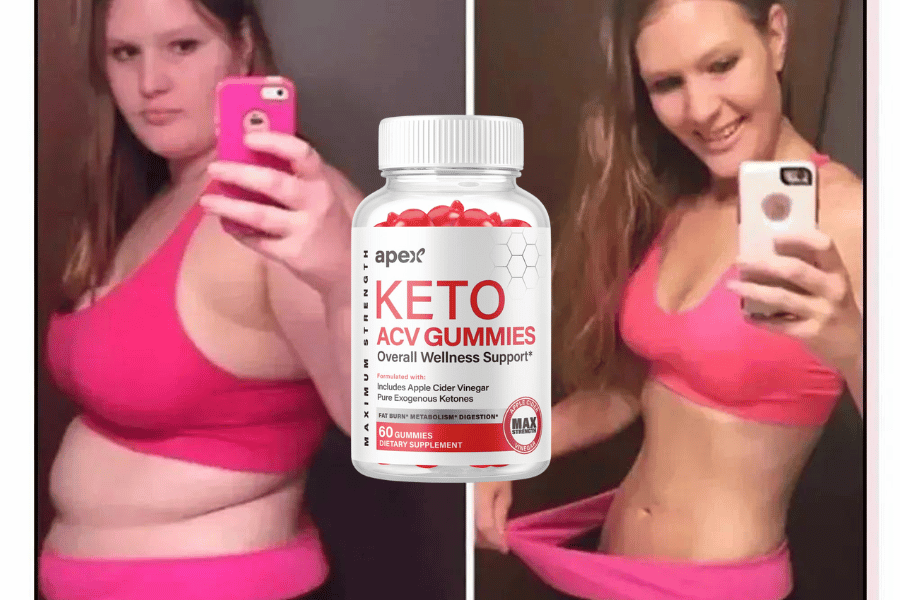 apex keto gummies