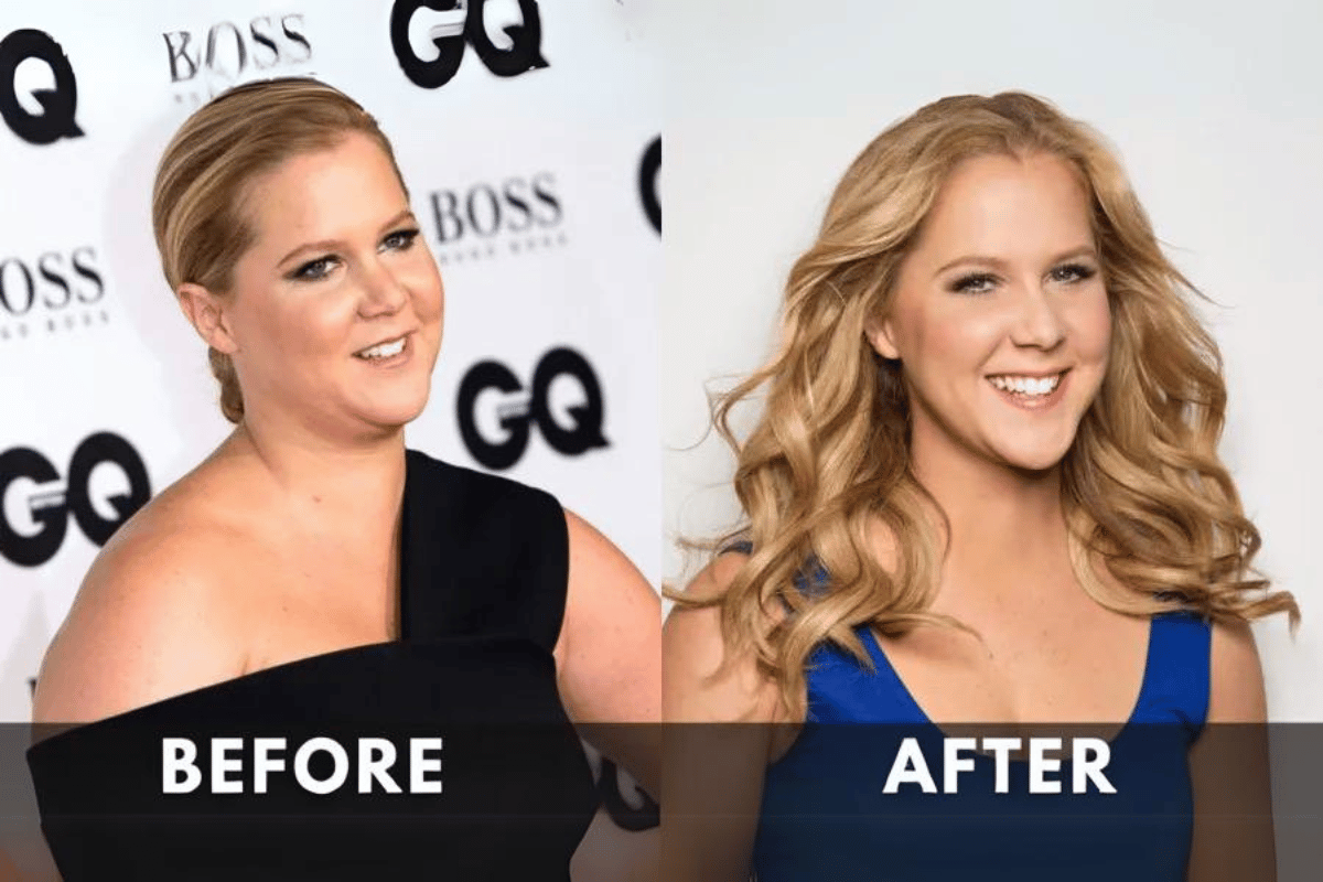 Amy Schumer weight loss