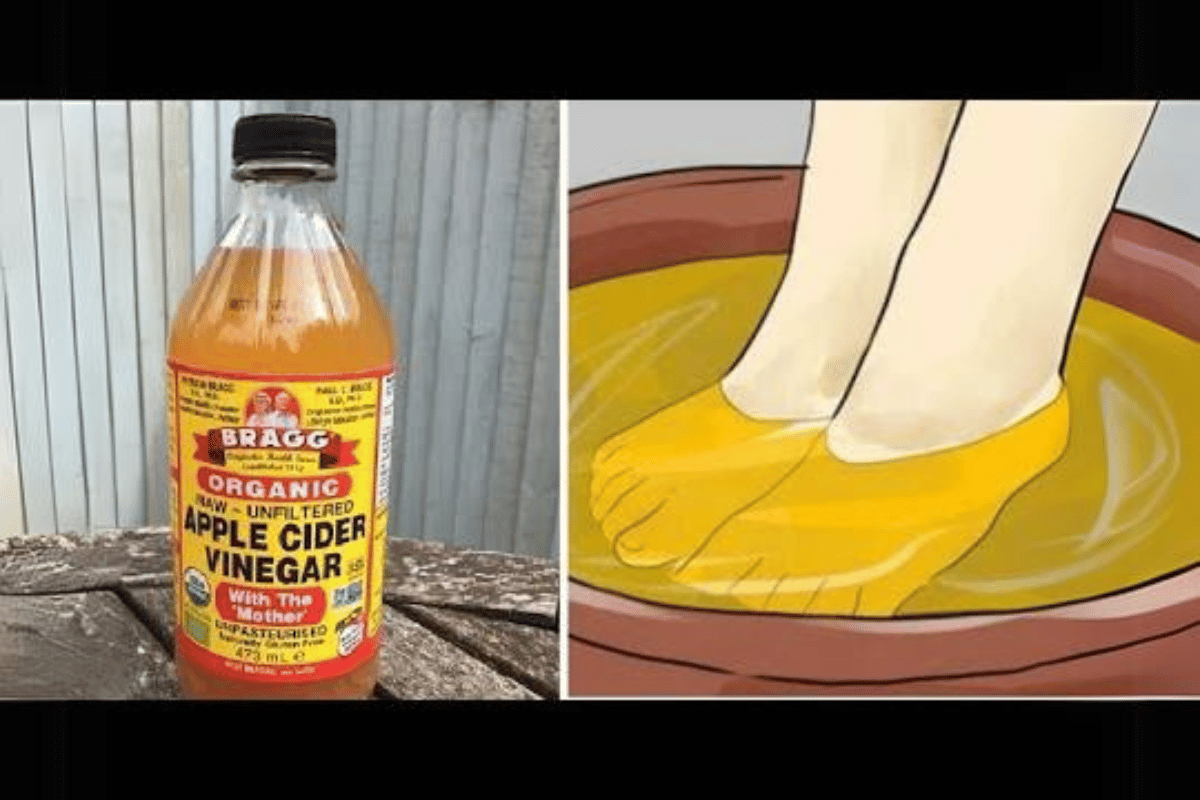 apple cider vinegar feet weight loss