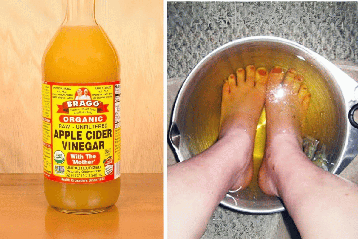 apple cider vinegar feet weight loss