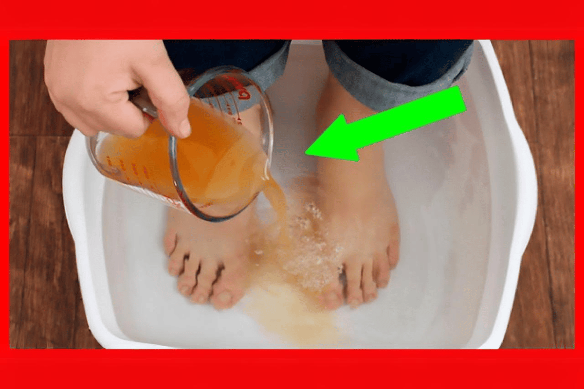 apple cider vinegar feet weight loss