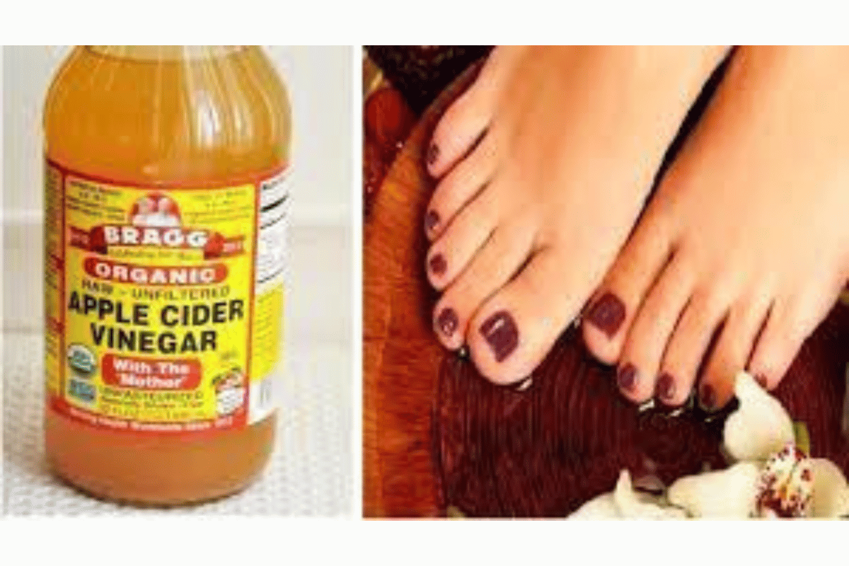 apple cider vinegar on feet overnight for weight loss