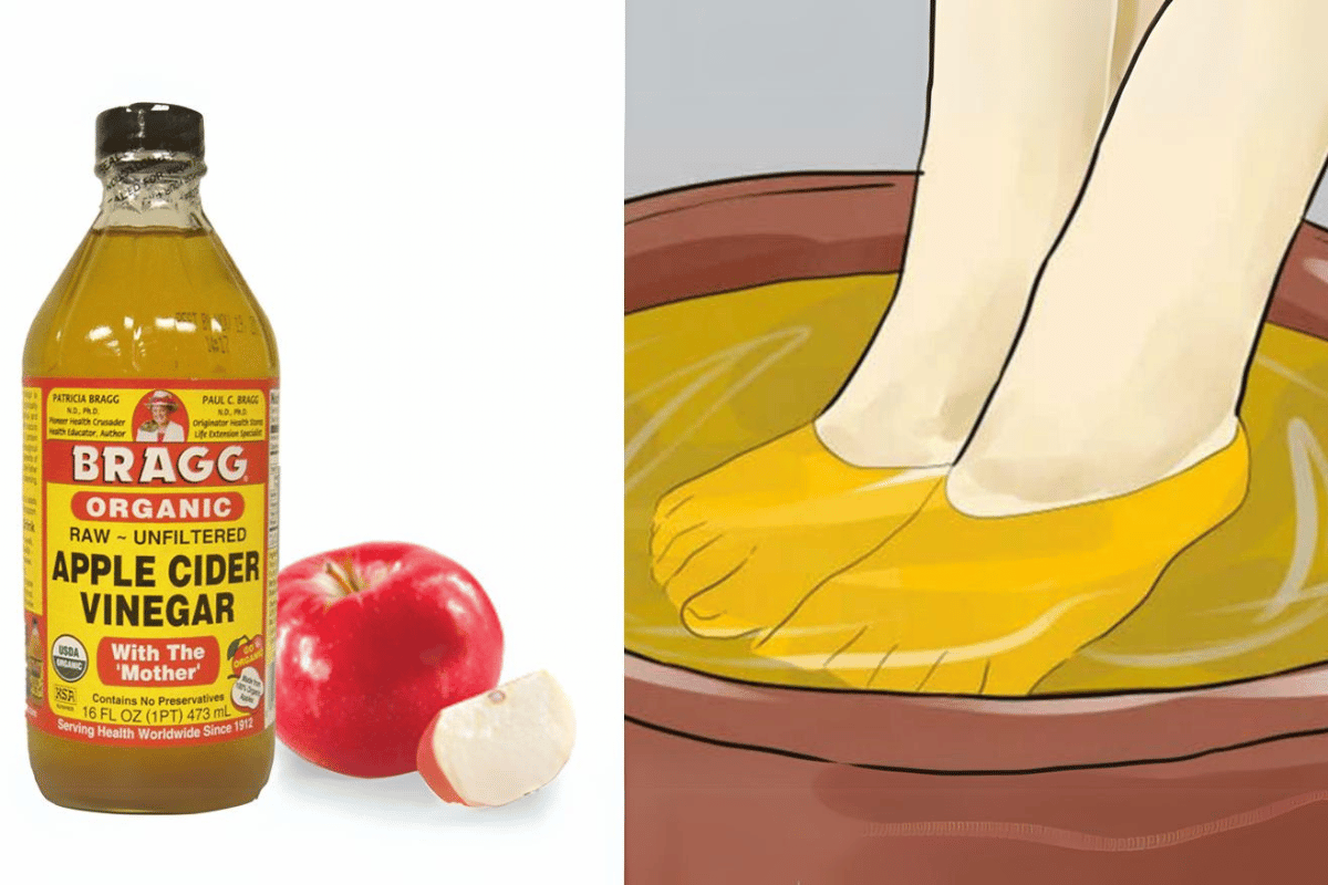 apple cider vinegar on feet weight loss