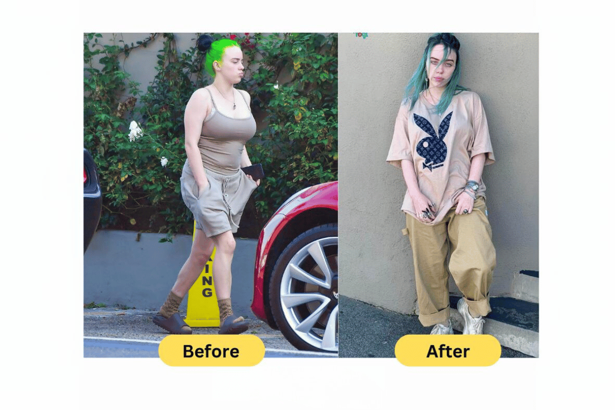 Billie Eilish weight loss