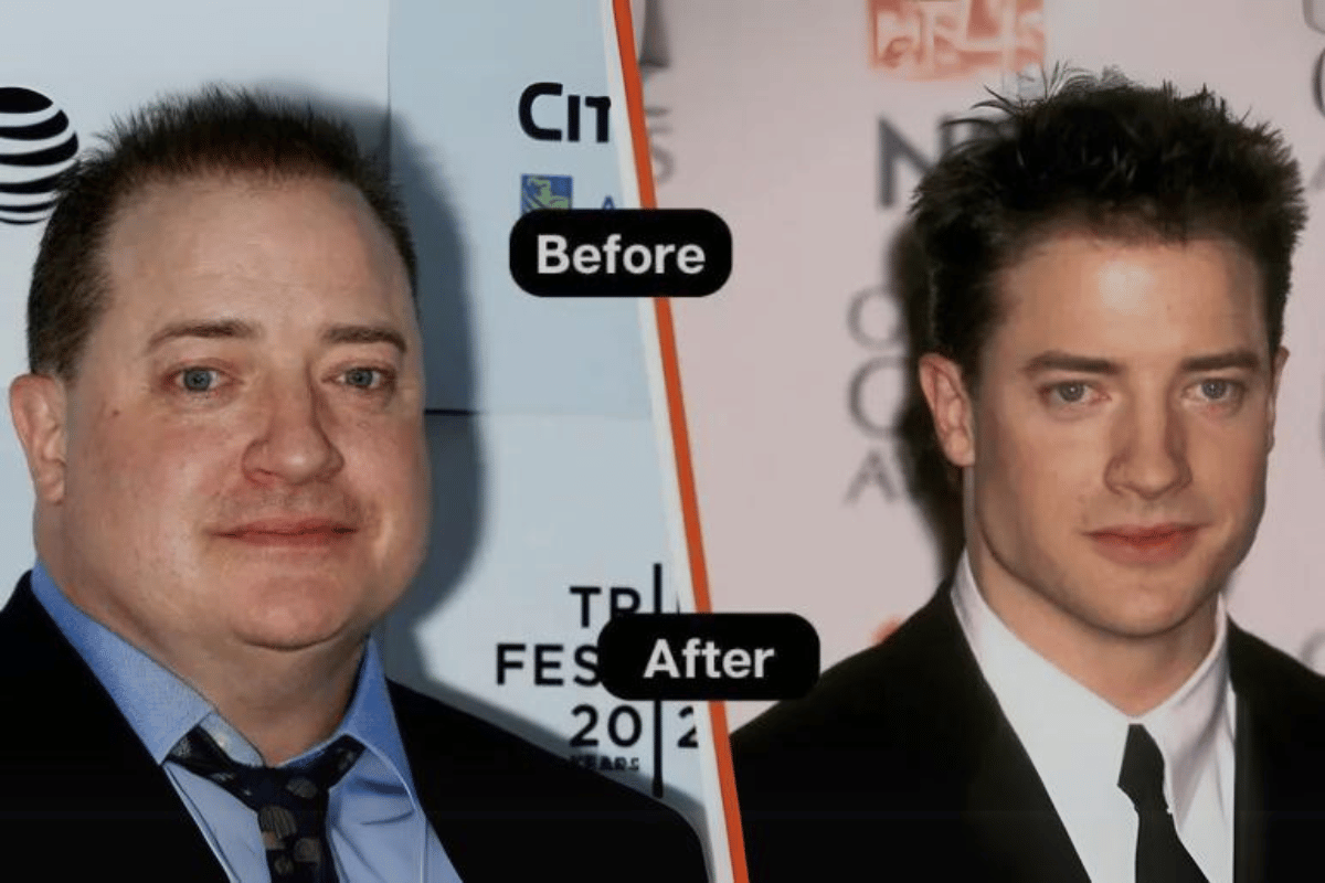 Brendan Fraser weight loss