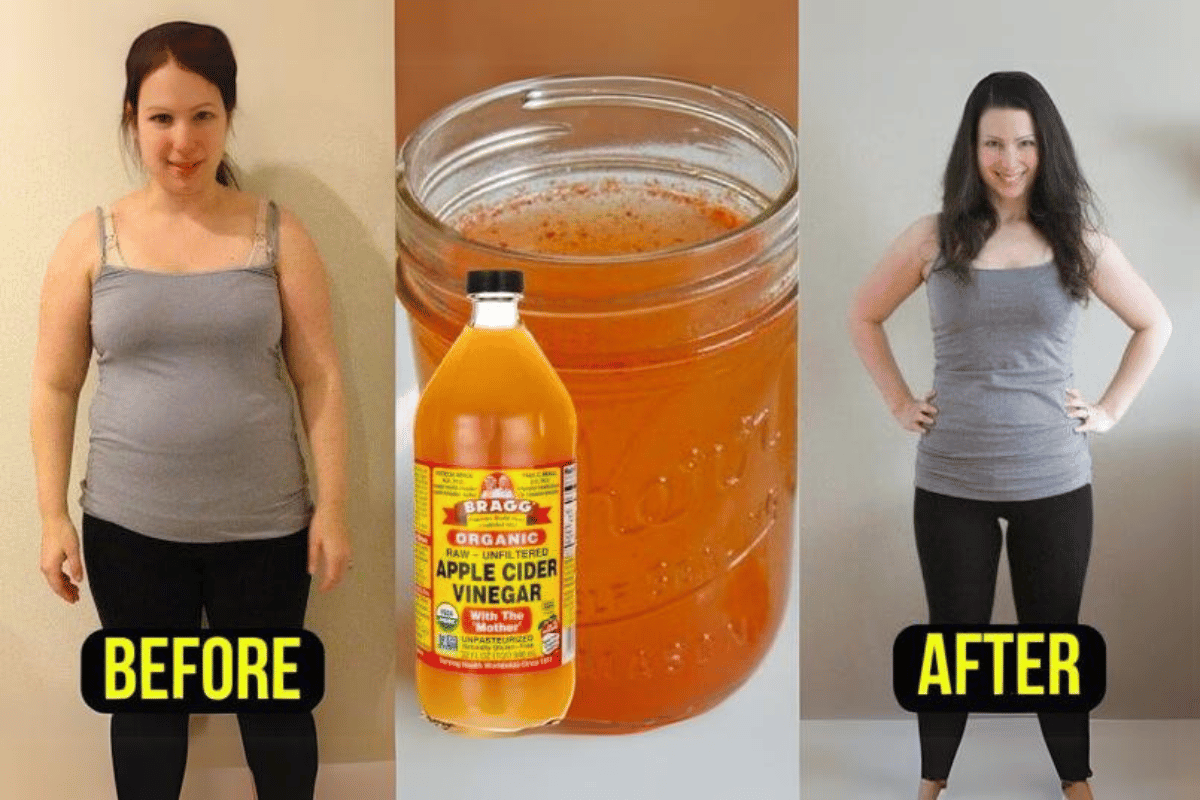 does apple cider vinegar help you lose weight