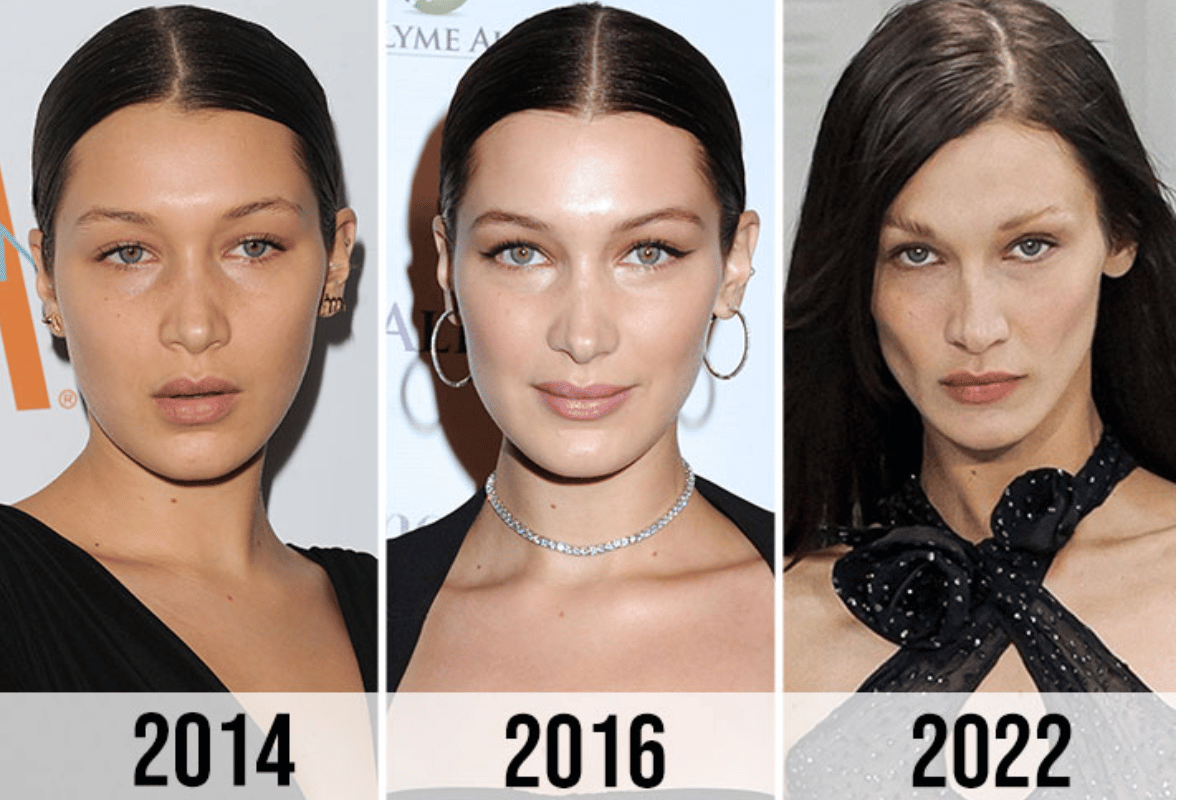 bella hadid weight loss