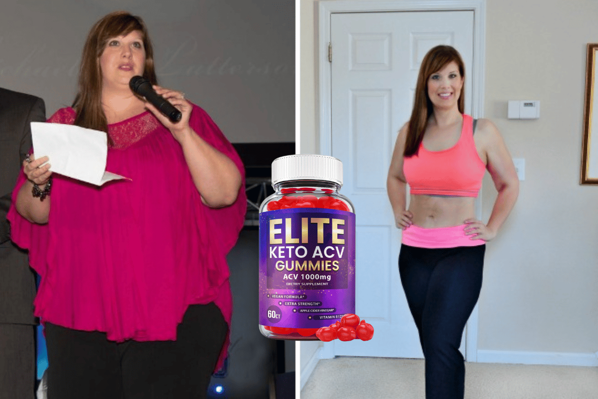 elite keto acv gummies reviews