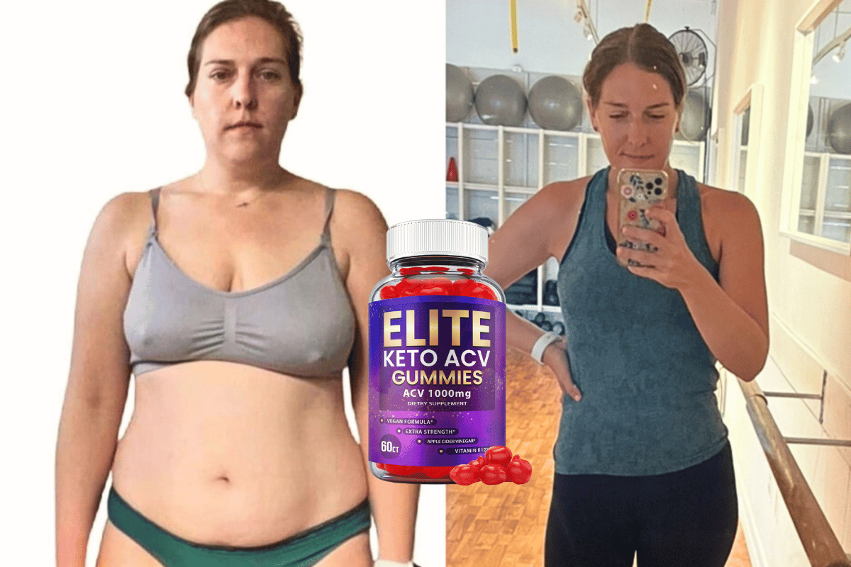 elite keto acv gummies reviews