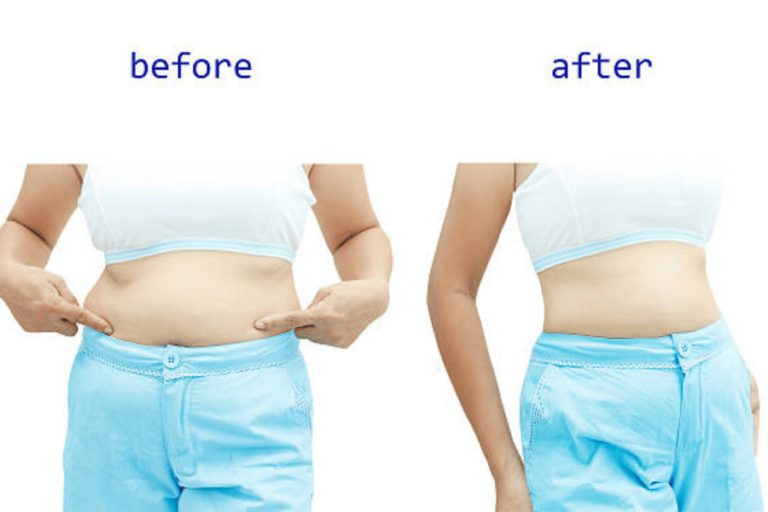Extreme 20 Audience Weight Loss Pills Reviews: What Works Best for 100  American Women?  SkyNet Worldwide Express
