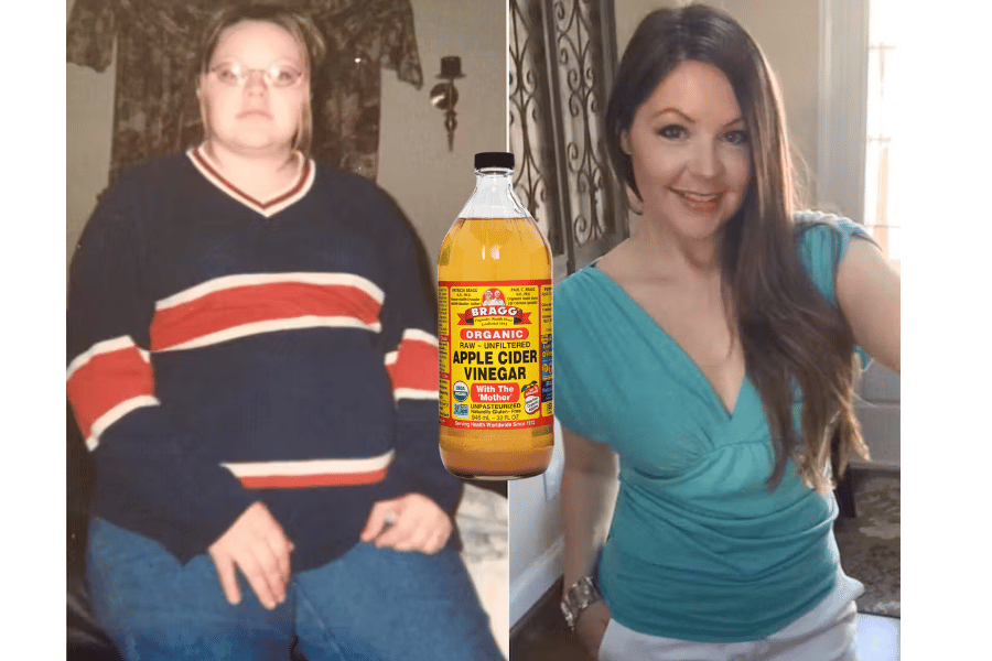 apple cider vinegar to lose weight