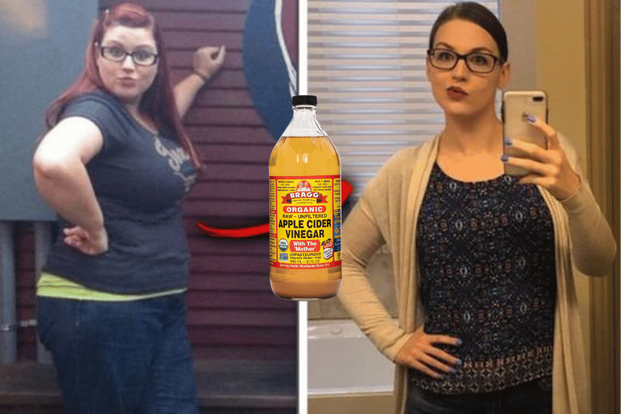 apple cider vinegar to lose weight