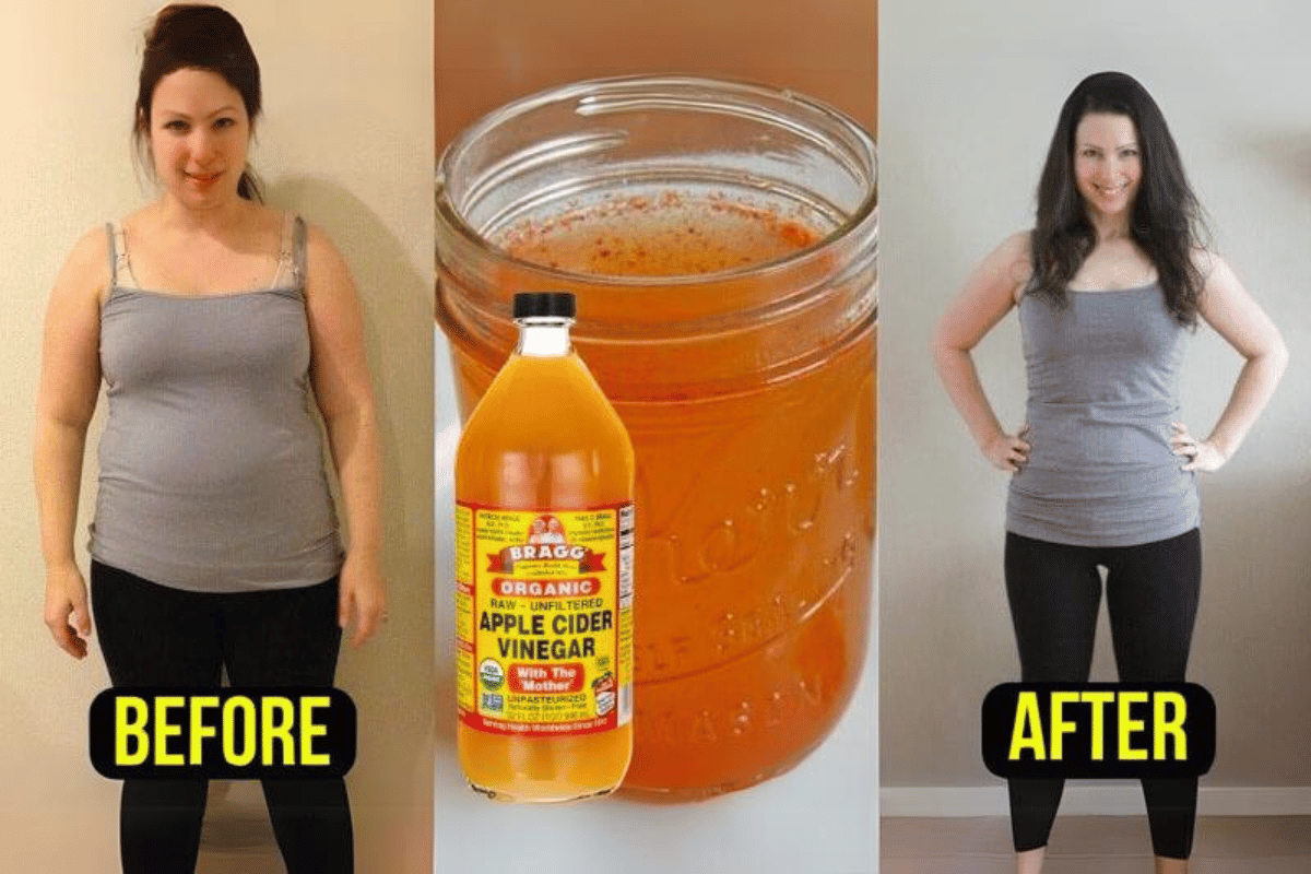 losing weight by drinking apple cider vinegar