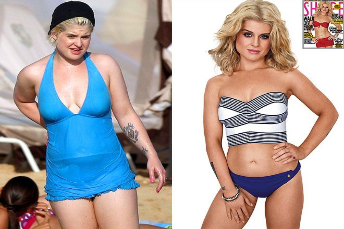 Did Kelly Osbourne Undergo Gastric Bypass Surgery?