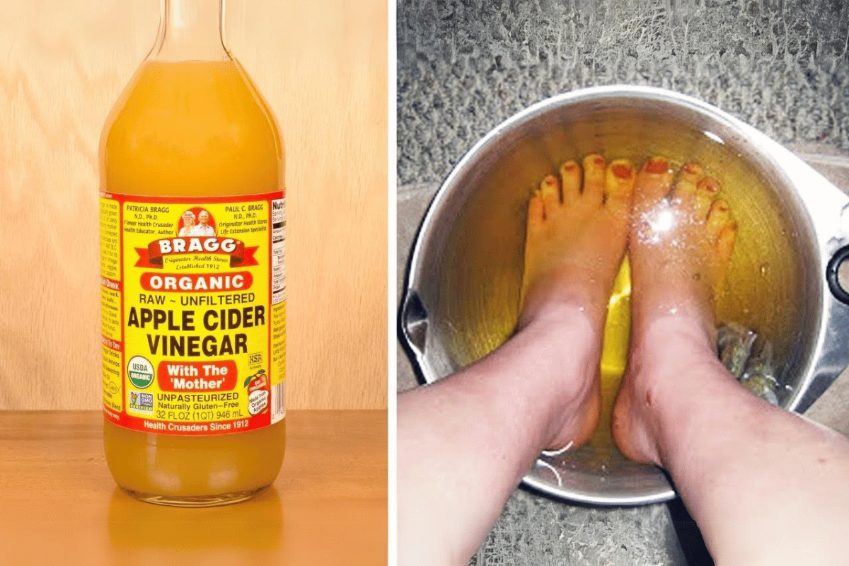 soaking feet in apple cider vinegar