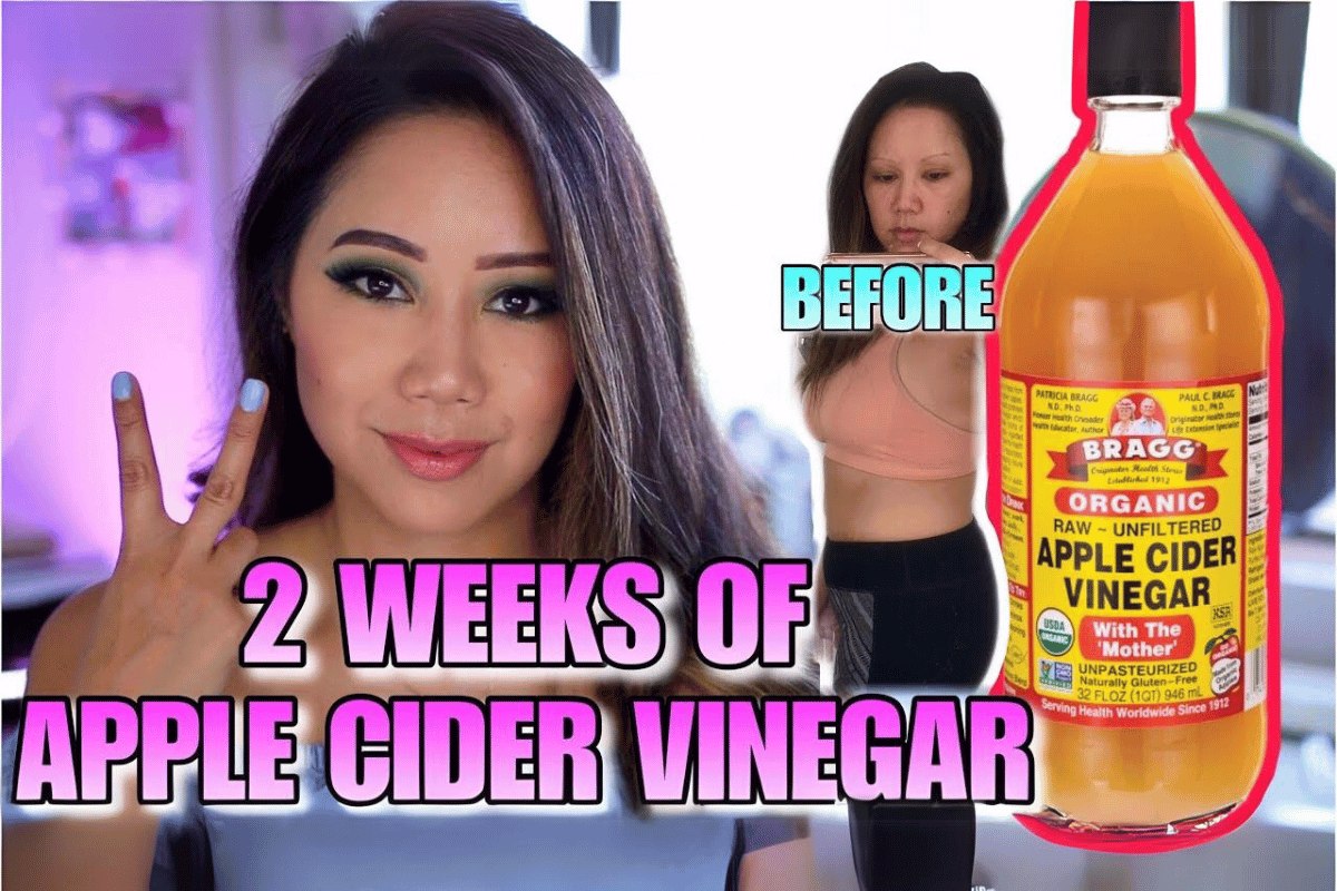 does apple cider vinegar lose weight