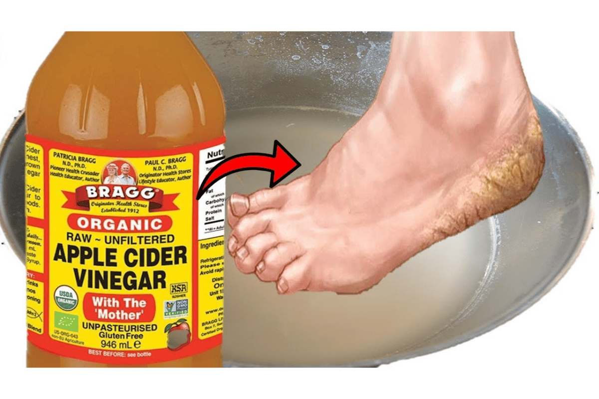 soaking feet in apple cider vinegar