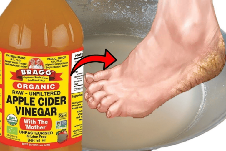 Soaking Feet in Apple Cider Vinegar and Epsom Salt for Weight Loss 7