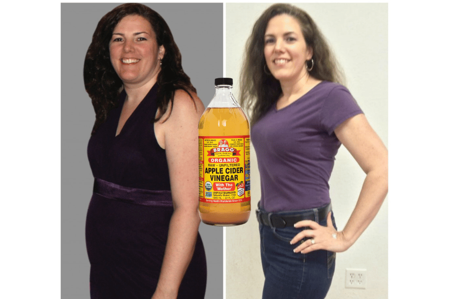 apple cider vinegar before and after weight loss