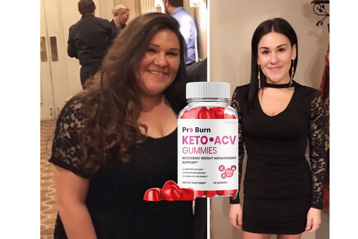 pro burn keto acv gummies reviews